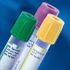 BD 367861 Venous Blood Collection Tube, <b>7.2mg K2 EDTA 13 X 75 mm, 4 mL, Lavender</b> Whole Blood, Clear Tube with Paper Label Plastic Tube, Sterile (100/Bx)<br><br><font color="red"><b>BACK TO THE PRODUCT TABLE, <a href="https://www.aaawholesalecompany.com/clinical-laboratory-laboratory-glassware-and-plasticware-bd-vacutainer-k2-edta-venous-blood-collecti.html">CLICK HERE</a></b></font>