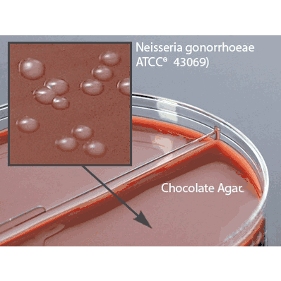 Prepared Media, 15 X 100 mm Bi-Plate Format Chocolate Agar / Martin Lewis with Lincomycin