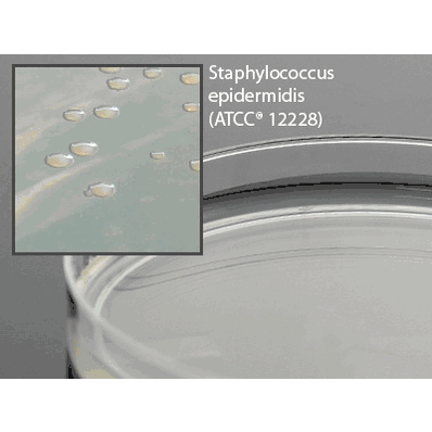 Prepared Media, 15 x 100 mm Deep Fill Plate Format Nutrient Agar Plate