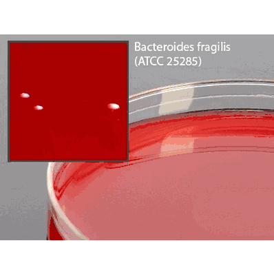 Prepared Media, 15 X 100 mm Mono-Plate Format Anaerobic Phenylethyl Alcohol Agar (CDC formula)