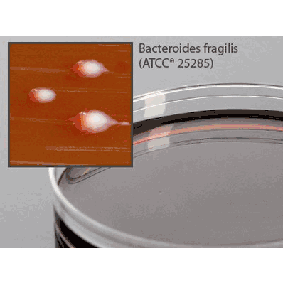 Prepared Media, 15 X 100 mm Mono-Plate Format LKV (Laked Sheep Blood, Kanamycin, Vancomycin) Agar