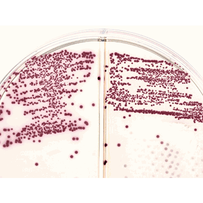 Prepared Media, 15 X 100 mm Mono-Plate Format Methicillin Resistant Staphylococcus Aureus