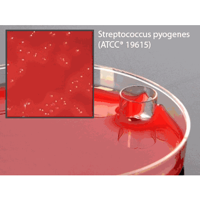 Prepared Media, 15 x 100 mm Petri Plate Selective Strep Agar Plate