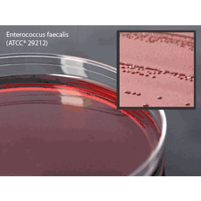 Prepared Media, 15 x 100 mm Plate Format Levine Eosin Methylene Blue (EMB) Agar