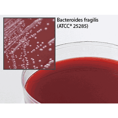 Prepared Media, 15 X 100 mm Plate Format Neomycin Anaerobic Blood Agar