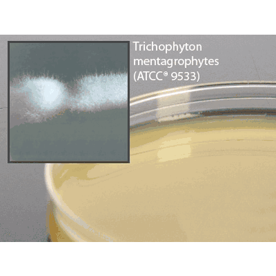 Prepared Media, 15 x 103 mm, 5 mL Tube Format Nutrient Broth