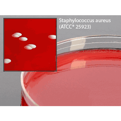 Prepared Media, 18 mL Mono-Plate Format, 15 x 100 mm Phenylethyl Alcohol Agar with 5% Sheep Blood