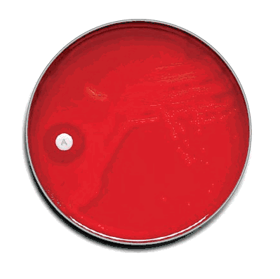 Prepared Media, 20 Plates Group A Selective Strep Agar with 5% Sheep Blood