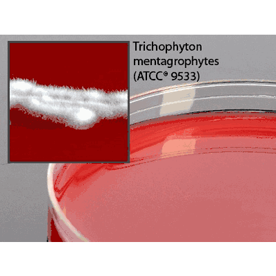 Prepared Media, 26 mL, 15 X 100 mm Deep Fill Plate Format, Brain Heart Infusion (BHI) Agar with Blood