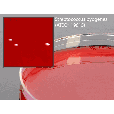 Prepared Media, 26 mL Fill, 15 X 100 mm Petri Plate Format Tryptic Soy Agar (TSA) with Lecithin and Tween 80