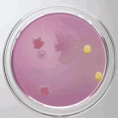 Prepared Media, Columbia Anaerobic Sheep Blood Agar Plate