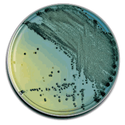 Prepared Plated Media, 100 x 10mm and 100 x 15mm-style plates CIN Agar (Yersinia Selective)