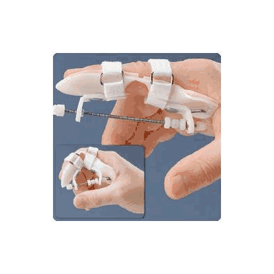 Progressive Extension Finger Splint Rolyan S