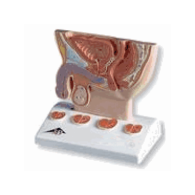 Prostate Model, 1/2 Natural