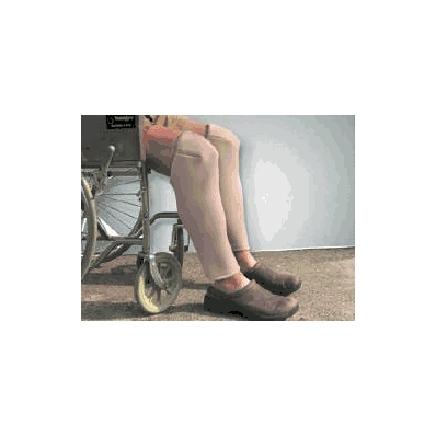 Protective Leg Tube Dermasaver Small - Leg-s