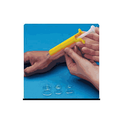 Pump, Scar Contains Syringe Ylw - - Sammons