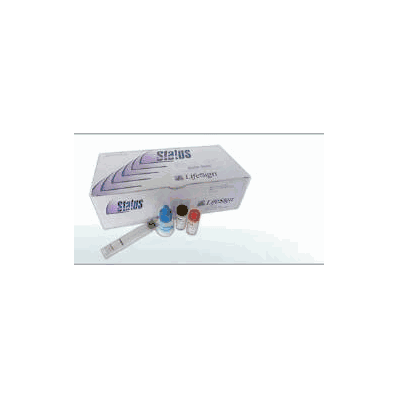 Rapid Test Kit, 25 Tests Infectious Mononucleosis Infectious Disease Immunoassay