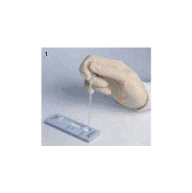 Rapid Test Kit, HIV Detection Infectious Disease Immunoassay