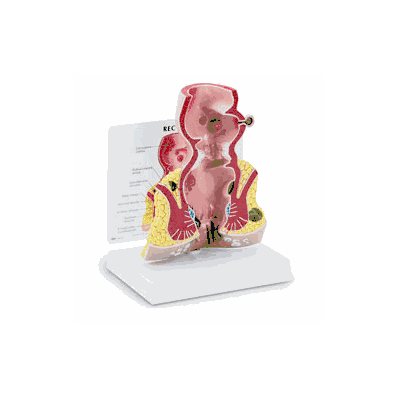 Rectum, Model Size 5-1/2" x 2-1/2" x 7"