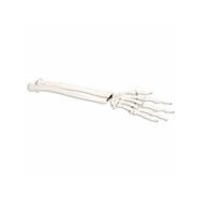 Right Hand Skeleton with portions of Ulna and Radius