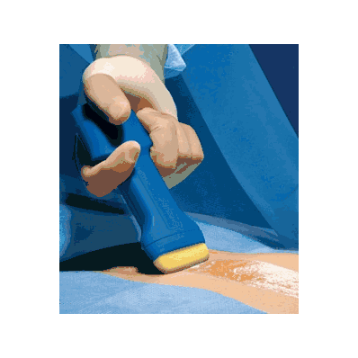 Sealant, Skin Prep, Microbial, 10"X10" - Medl