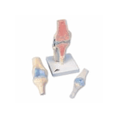 Sectional Knee Joint Model, 3 part