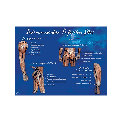 Set, Injection Site, Intramuscular - Medline