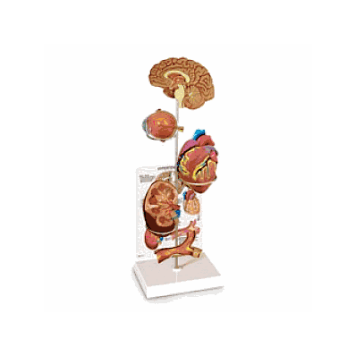 Set, Model, Hypertension - Medline