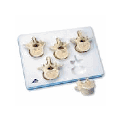 Set of 5 Lumbar Vertebrae