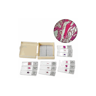 Slide Set, Human Pathology 12 - - Nasco