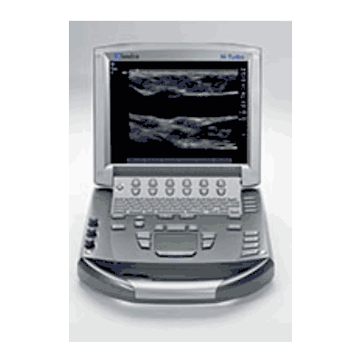 Sonosite M-Turbo Portable Ultrasound