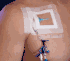 SorbaView 2000, SV30N2XT, Window Dressing, 2.5" x 3" Arterial/Peripheral IV with 2 Notch, Sterile (100/Cs) by Centurion<br><b><font color="red"> BACK TO THE CENTURION PRODUCTS, <a href="http://www.aaawholesalecompany.com/wound-care-general-wound-care-general-purpose-dressings-i-v--and-tracheostomy-dressings-dressings-by.html">CLICK HERE</a></font></b> <br><br> To See more of Centurion Dressings & Securement Products, <a href="http://site.aaawholesalecompany.com/Files/Centurion_Products.pdf">CLICK HERE</a>
