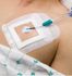 SorbaView 2000, SV30NXT3, Window Dressing, 2.5" x 3" Arterial/Peripheral IV, Sterile (50/Cs) by Centurion<br><b><font color="red"> BACK TO THE CENTURION PRODUCTS, <a href="http://www.aaawholesalecompany.com/wound-care-general-wound-care-general-purpose-dressings-i-v--and-tracheostomy-dressings-dressings-by.html">CLICK HERE</a></font></b> <br><br> To See more of Centurion Dressings & Securement Products, <a href="http://site.aaawholesalecompany.com/Files/Centurion_Products.pdf">CLICK HERE</a>