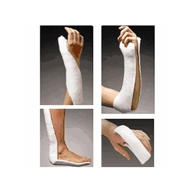 Splint, Ortho Glass Solo 4x30