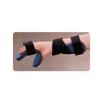 Splint, Quick Form, Progressive, R-value