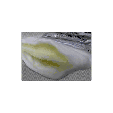 Splint Roll Ezy Splint 1 Inch X 15 Foot - S