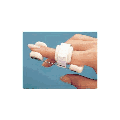 Spring Wire Safety Pin Splint Bunnell X-smal