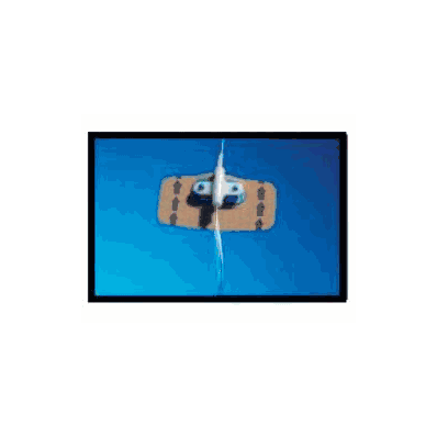 Statlock Device, Neonate PicC/Cvc Catheter (5