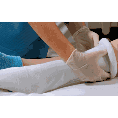 Stockinette, Polyester, 6"X25yds - Medline