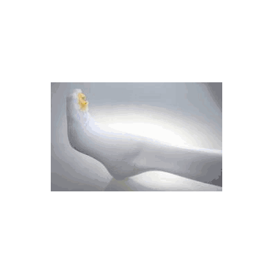 Stocking, Anti-emb KneE Short Post-op Xlg (12
