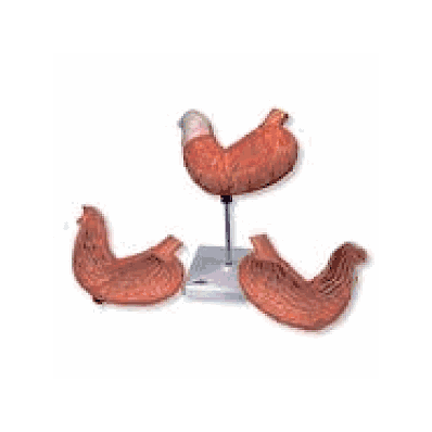 Stomach, 2 part