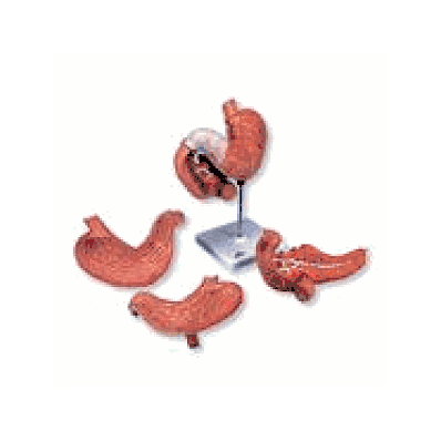 Stomach, 3 part
