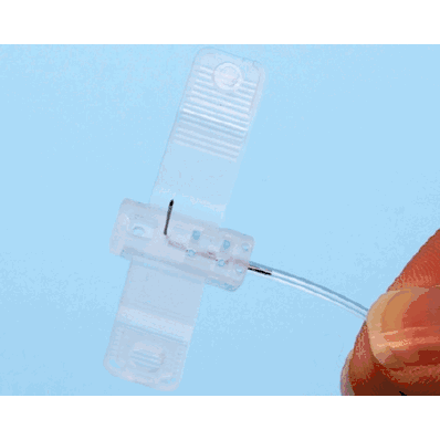 Sub-Q Infusion Set, 24 ga Custom Luer, 6 mm Winged Backcut Single Needle