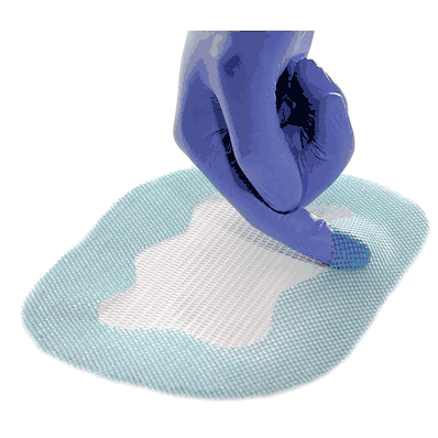 Symbotex SYM2012E Composite Mesh, 20 cmx 12 cm