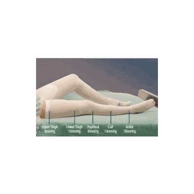 T.E.D. Anti-embolism Stockings Knee-high 2 X