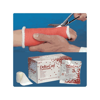 Tape, Cast, Delta 2"X4yd Red