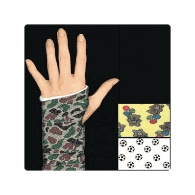 Tape, Cast Tape, 2x4yd, Camouflage