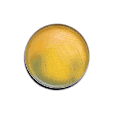 Test Media BD BBL Trypticase Soy Agar With 5