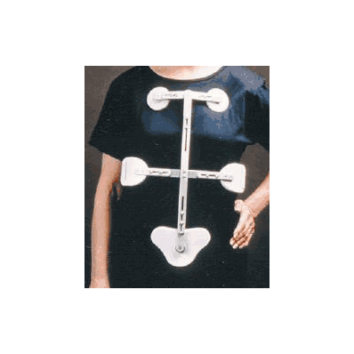 Thoracic Orthosis, Cash W/Articulating Pect E