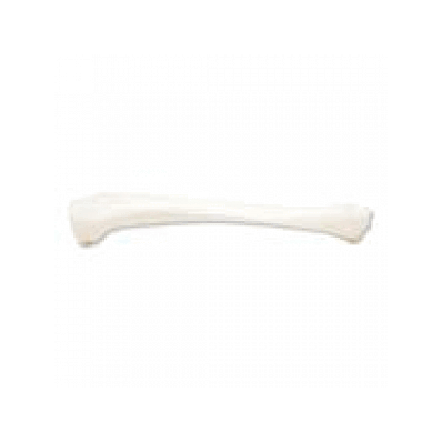 Tibia, Left
